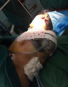 女子手臂被钢筋切割机绞上 血喷不止