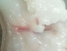 食客买了一块猪肉 看见疑似“肉虫”的东西
