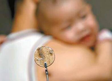 一枚小小的硬币   4岁小孩将她吞了下去