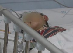 4岁男童一口干掉半斤白酒3天不醒  家长:能喝半碗啤酒