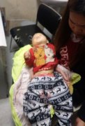 重庆1岁男童被自家犬咬掉私处