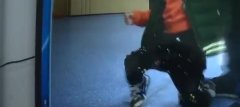 2岁男童走路不稳 竟是患了脑瘤