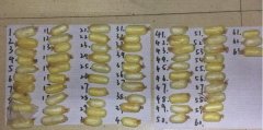 男子吞下63包毒品 “人体运毒”竟为还赌债
