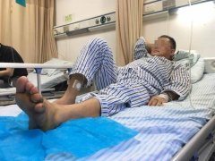 听信偏方用治脚溃疡 重庆一男子差点截肢